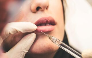 Patient receiving injection - 5 Things You Didn't Know About Dermal Fillers - Dermal fillers in Palm Beach County