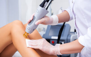 woman receiving laser hair removal - is laser hair removal permanent concept